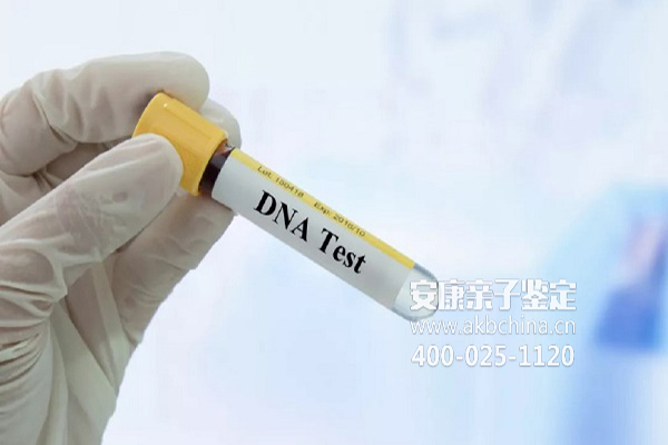 广西广东人口普查多少人没DNA 广东DNA亲子鉴定多少钱 
